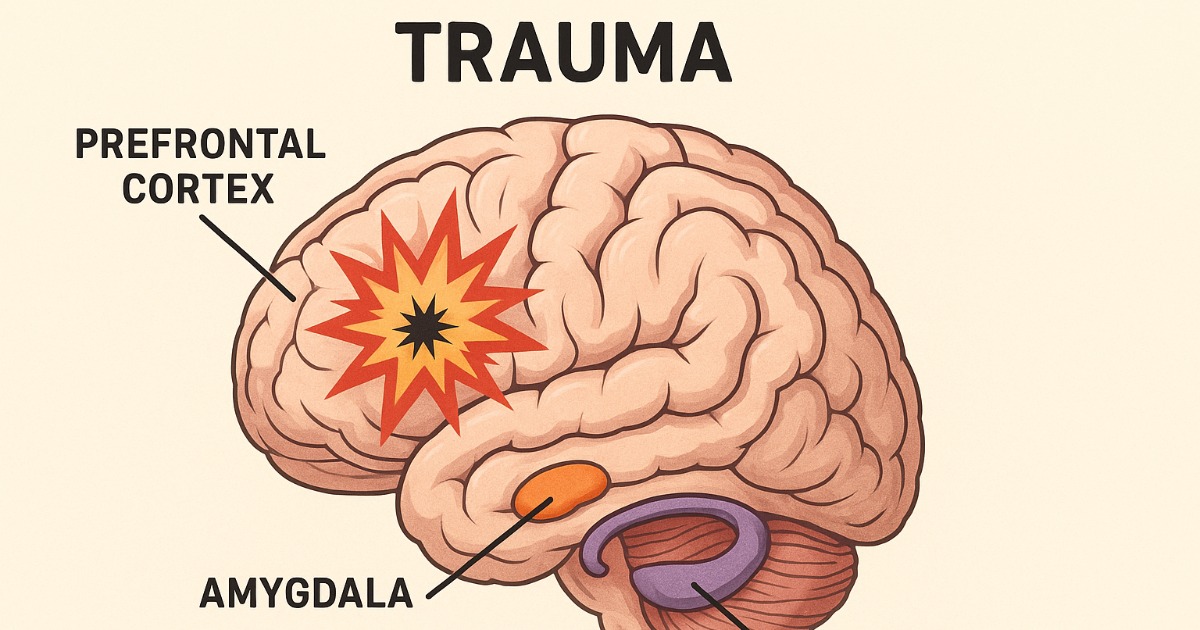 Brain diagram showing trauma impact on prefrontal cortex and amygdala with explosion visualization
